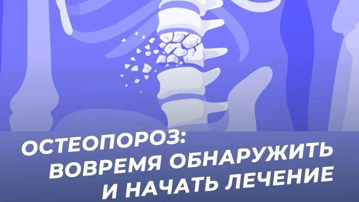 Врач‑эндокринолог Подмосковья рассказала о важности профилактики остеопороза