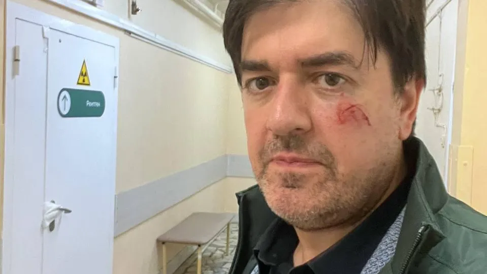 Неадекват напал на адвоката Асада Юсуфова в Красногорском городском суде