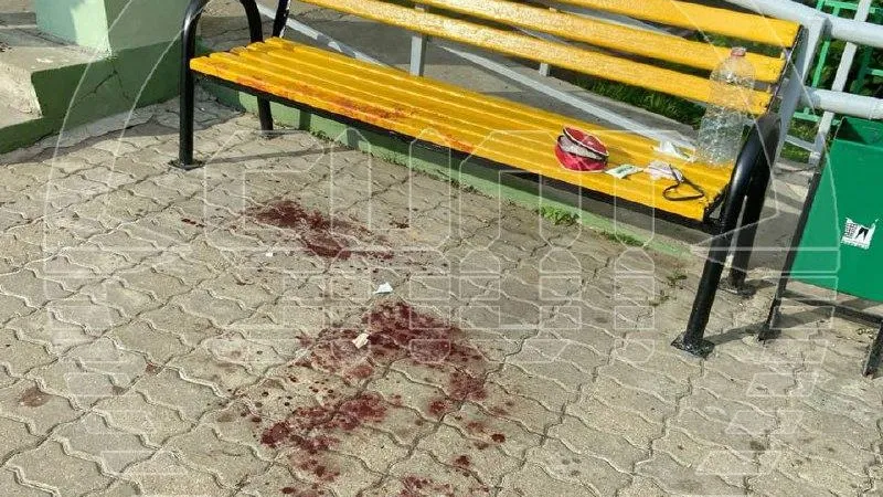 Отрезал 2 пальца и сдался: стали известны подробности нападения в Балашихе