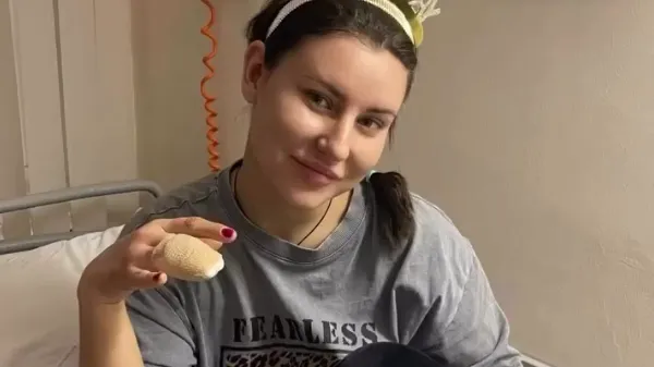 Неудачное падение: стол отрубил пальцы россиянке за день до 30-летия