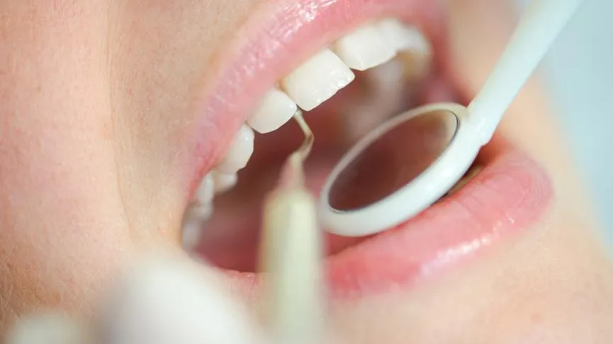 Российские ученые научились выявлять кариес, который не виден глазу человека