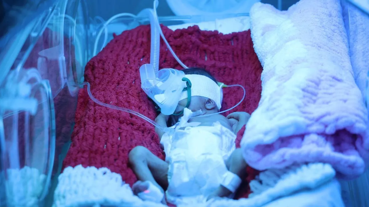 В Балашихе врачи спасли недоношенных близнецов с весом менее килограмма весной 2025 года