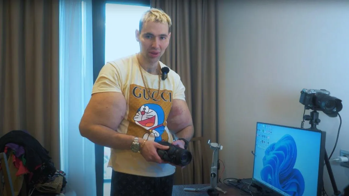 Одна из рук-«базук» Кирилла Терешина лопнула, он готовится к операции