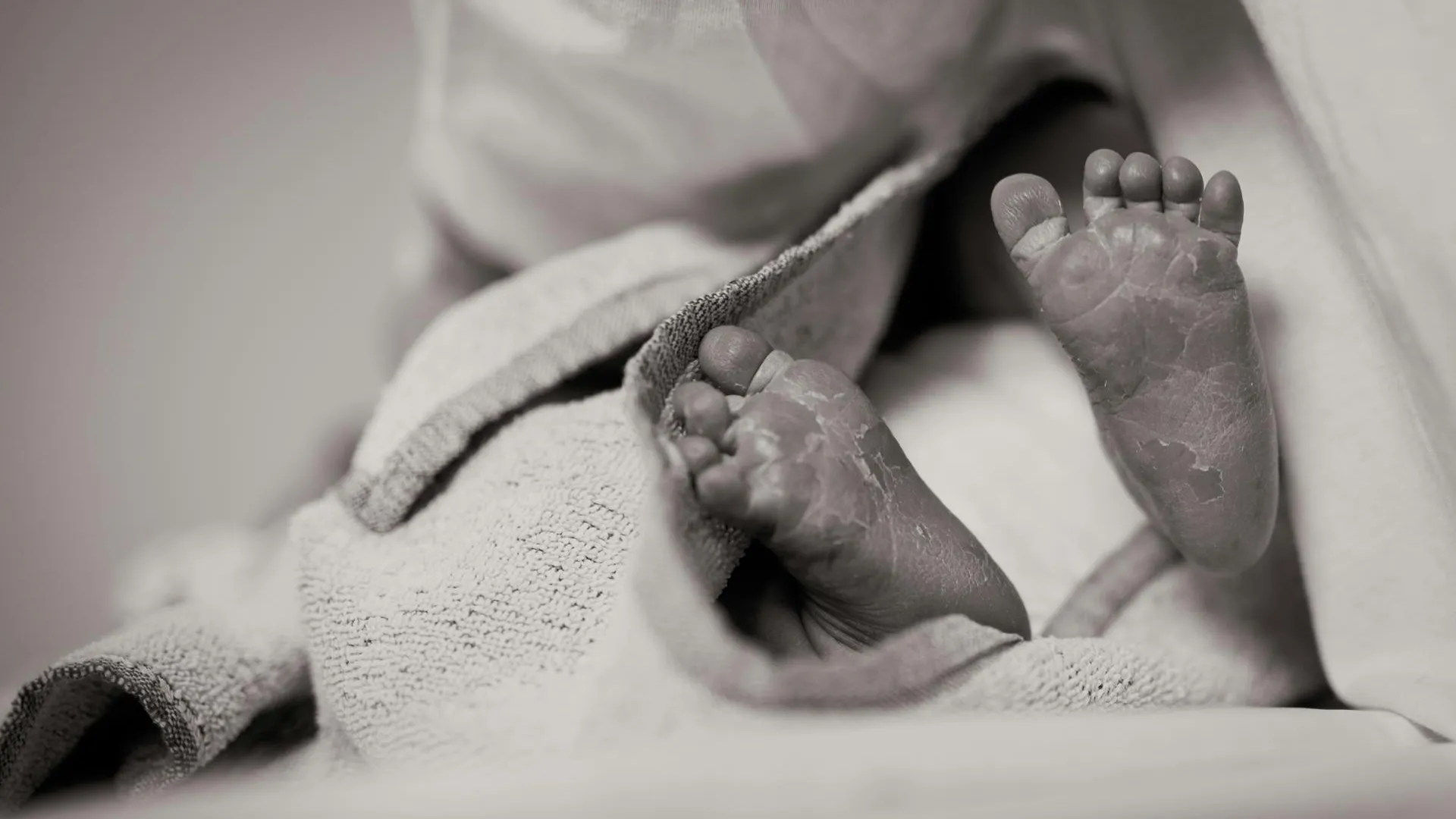 Врачи перепутали детей в роддоме Люберец и сожгли одному из них лицо
