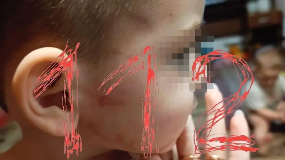 Под Краснодаром женщина жестоко избила 3-летнего сына, ребенка спасла тетя