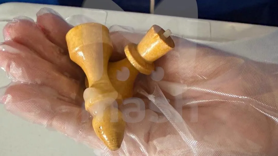 Почти гроссмейстер: мужчина вставил в анус ферзя и слона и попал в больницу