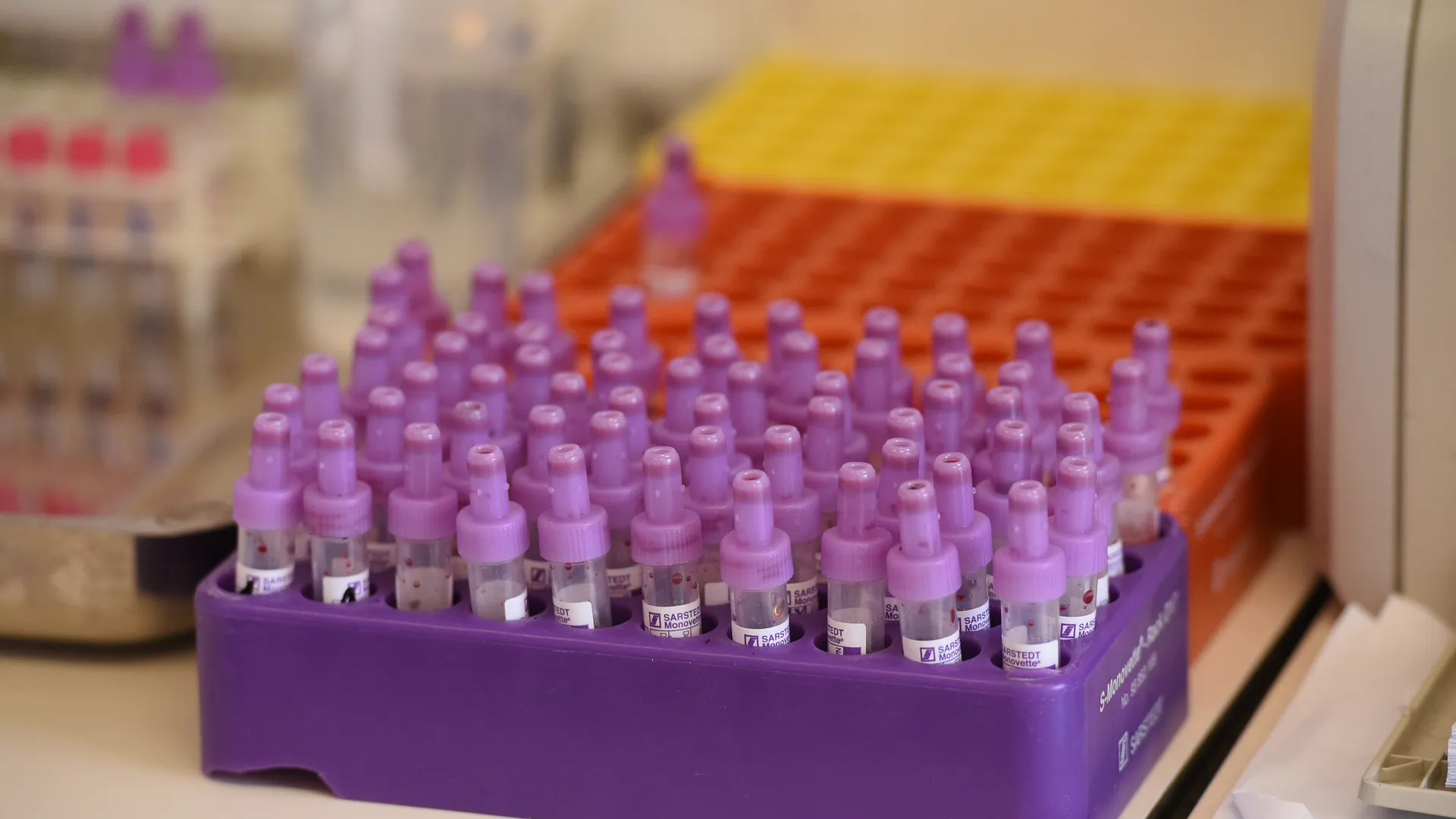 Baza: заболеваемость ВИЧ-инфекцией растет в регионах России