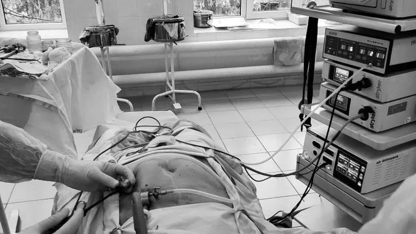 В больнице Егорьевска провели операцию по восстановлению передней брюшной стенки