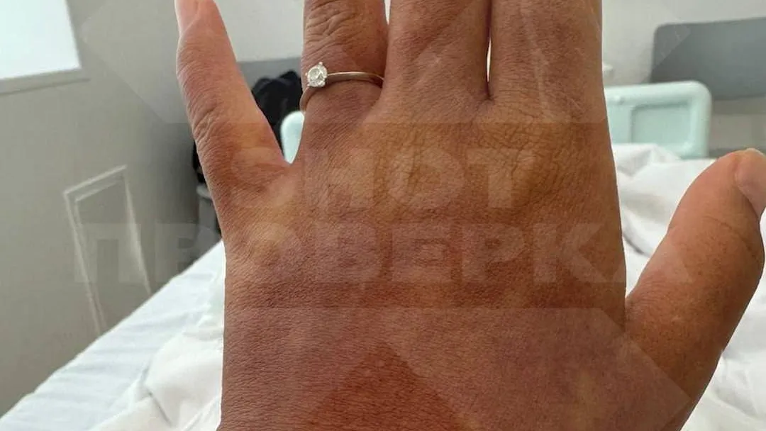 У российских туристов на Мальдивах диагностируют смертельную лихорадку денге