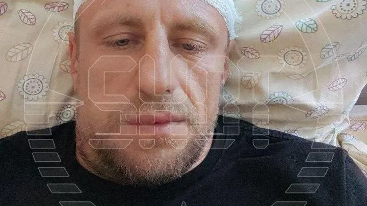 Ветеран СВО получил перелом черепа после нападения кандидата в мундепы Ялты