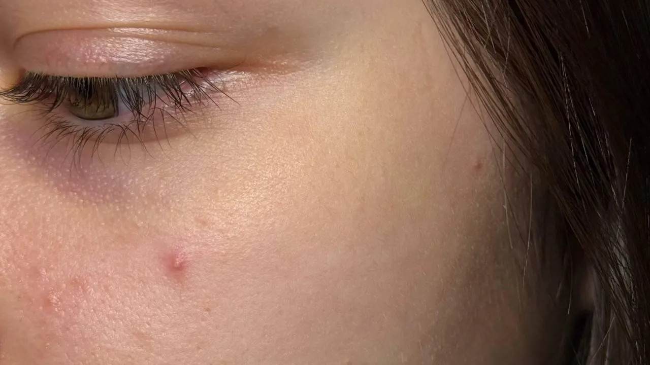 Врач из Подмосковья объяснила влияние депрессии на кожу