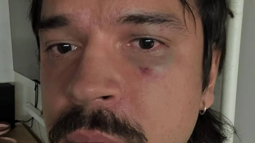 Московского дизайнера Никиту Калмыкова избили и ограбили в туалете