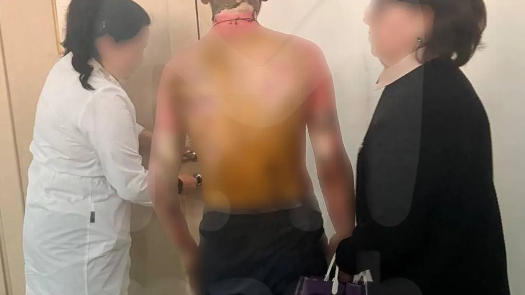 Пересадка кожи потребуется пострадавшему при нападении на школу Красноярска