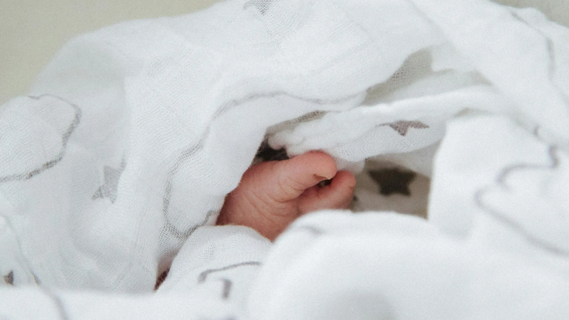 В Индии родился малыш с двумя лицами, четырьмя руками и четырьмя ногами