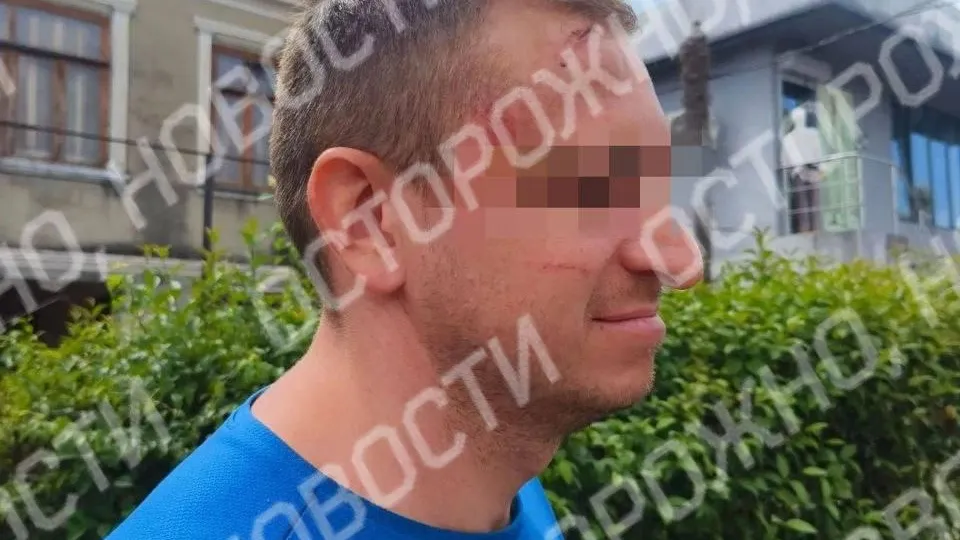 «Убивай русских!» В Абхазии водители экскурсионных джипов избили россиян