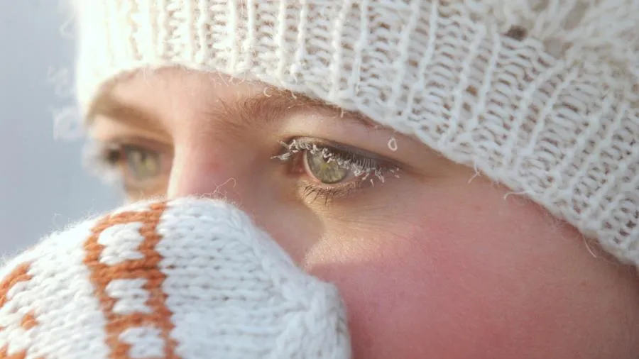 Врач рассказала, как распознать обморожение и не сделать хуже в первые минуты