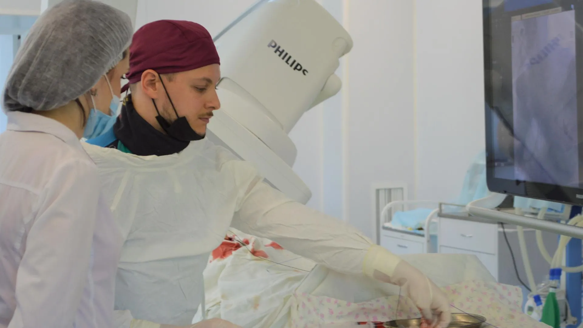 Врачи Ступинской больницы впервые провели эмболизацию при миоме