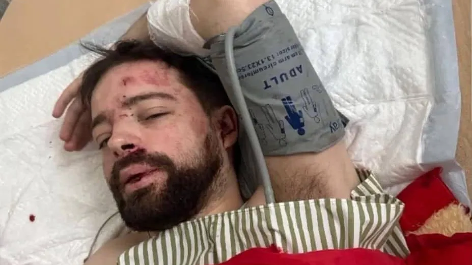 Встреча с ТЦК закончилась для преподавателя из Львова проломленной головой