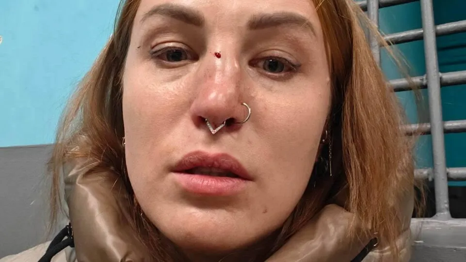 Выпрашивал деньги и сломал нос: мужчина напал на пассажирку в метро Москвы