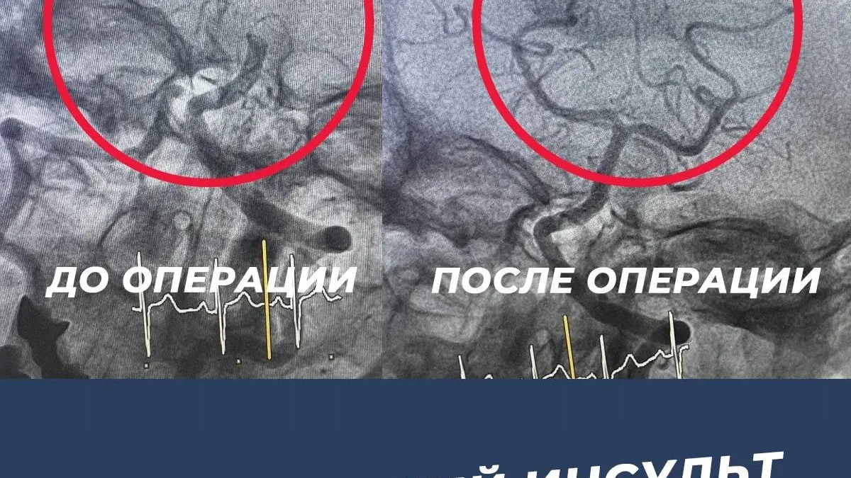 После операции кровоток полностью восстановился