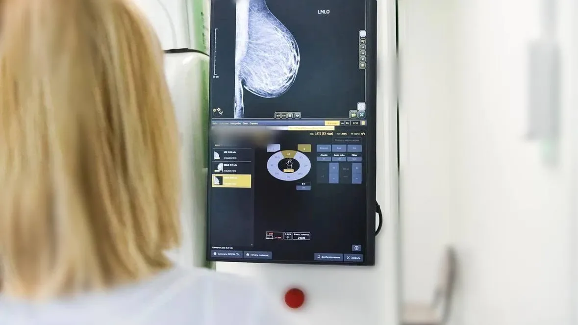 В Подмосковье на 23% выросло число женщин, прошедших маммографию по самозаписи в 2025 году