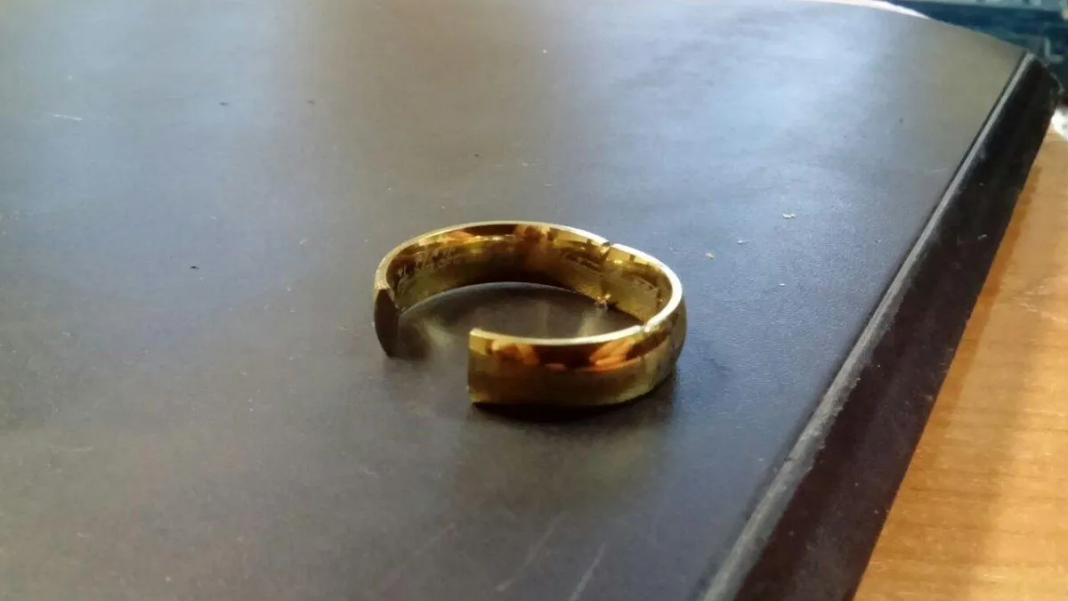 Можайские спасатели сняли с отекшего пальца женщины застрявшее кольцо