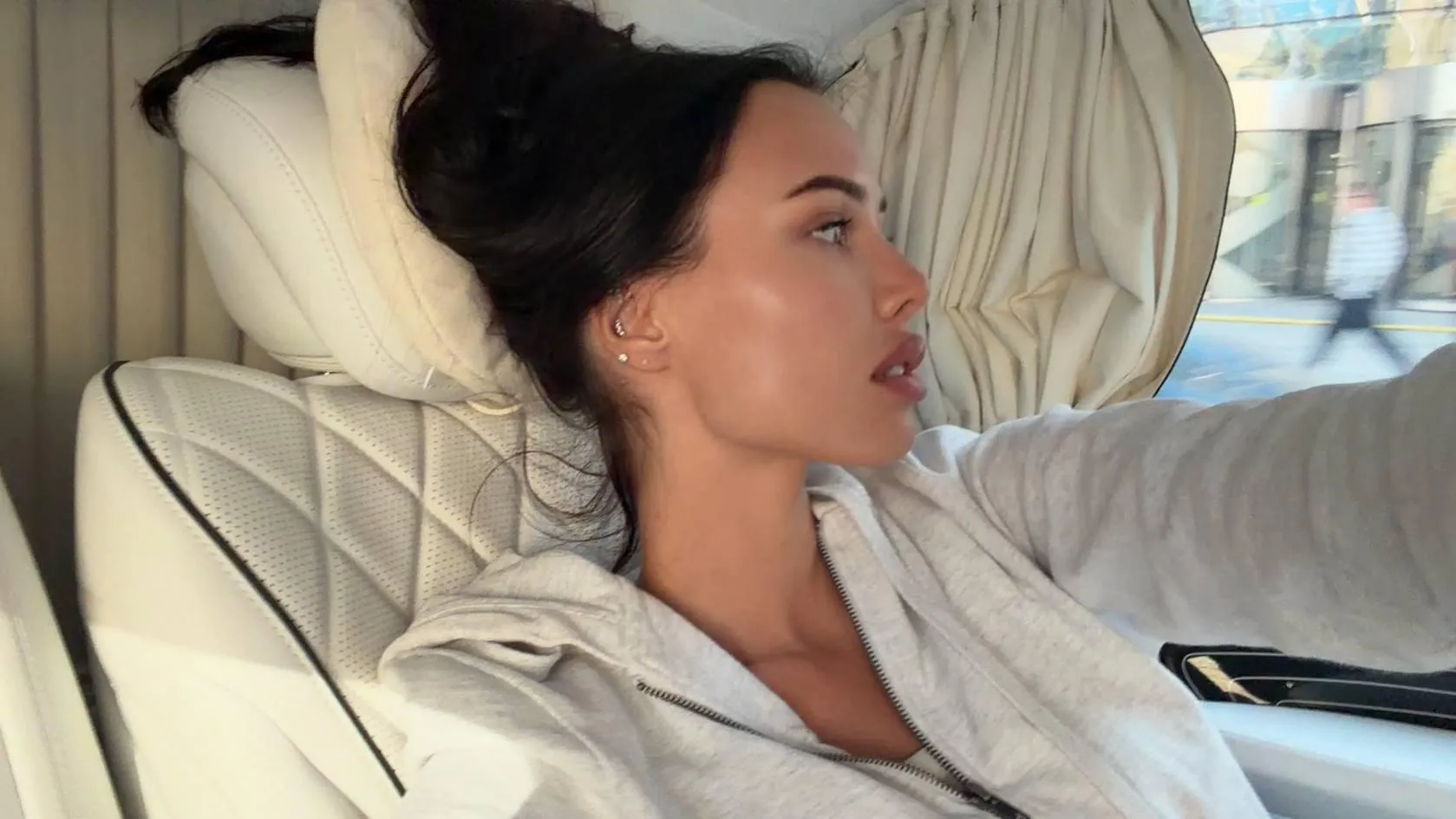 Анастасия Решетова показала себя после удаления филлеров из губ